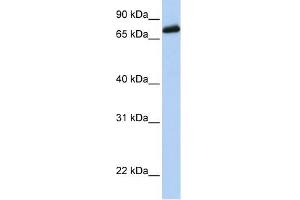 LRCH4 antibody used at 1 ug/ml to detect target protein. (LRCH4 anticorps)