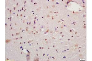 Formalin-fixed and paraffin embedded rat brain labeled with Anti-MAPK organizer 1 Polyclonal Antibody, Unconjugated (ABIN720475) at 1:200 followed by conjugation to the secondary antibody and DAB staining (MORG1 anticorps  (AA 201-315))
