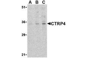 Western blot analysis of CTRP4 in rat brain cell lysate with AP30252PU-N CTRP4 antibody at (A) 1, (B) 2, and (C) 4 μg/ml. (C1QTNF4 anticorps  (C-Term))