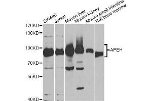 Western blot analysis of extracts of various cell lines, using APEH antibody. (APEH anticorps  (AA 1-260))