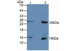 Figure. (CXCL7 anticorps  (AA 59-128))