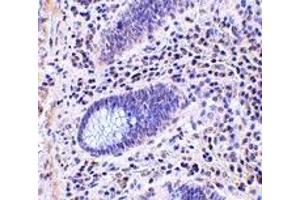 Immunohistochemistry (IHC) image for anti-Leucine Rich Repeat Containing 1 (LRRC1) (C-Term) antibody (ABIN1030477) (LRRC1 anticorps  (C-Term))