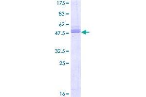 Image no. 1 for Proline-Rich Gla (G-Carboxyglutamic Acid) Polypeptide 2 (PRRG2) (AA 1-202) protein (GST tag) (ABIN1316447)