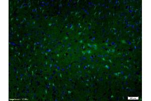 Formalin-fixed and paraffin embedded rat brain labeled with Anti-MAP2/MAP-2A.