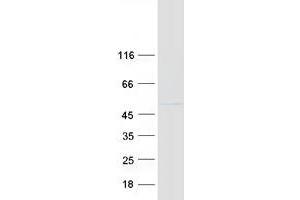 Validation with Western Blot