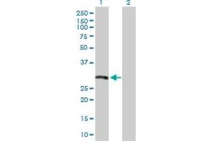 Western Blot analysis of HLA-DRB5 expression in transfected 293T cell line by HLA-DRB5 MaxPab polyclonal antibody. (HLA-DRB5 anticorps  (AA 1-266))