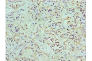 Immunohistochemistry of paraffin-embedded human kidney tissue using ABIN7151879 at dilution of 1:100 (Ephrin B2 anticorps  (AA 28-229))