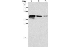 Western Blot analysis of Human endometrial carcinoma tissue, A172 and U937 cell using TWF2 Polyclonal Antibody at dilution of 1:800 (TWF2 anticorps)