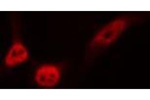 ABIN6276751 staining HeLa cells by IF/ICC. (ETS1 anticorps  (Internal Region))