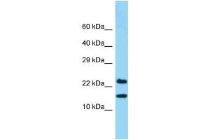 WB Suggested Anti-NDUFB10 Antibody Titration: 1.