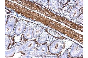 IHC-P Image alpha Cardiac Muscle Actin antibody detects alpha Cardiac Muscle Actin protein at cytoplasm on mouse small intestine by immunohistochemical analysis. (ACTC1 anticorps)