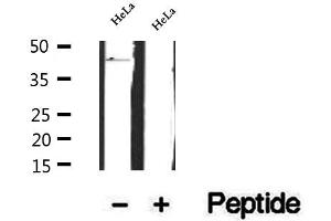 Western blot analysis of extracts of HeLa cells, using FBXO22 antibody. (FBXO22 anticorps  (Internal Region))