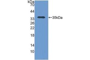 Western blot analysis of recombinant Human TOMM70A. (TOM70 anticorps  (AA 333-608))