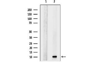 Western blot analysis of lysates from RAW264.