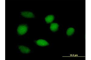 Immunofluorescence of purified MaxPab antibody to BLVRA on HeLa cell. (Biliverdin Reductase anticorps  (AA 1-296))