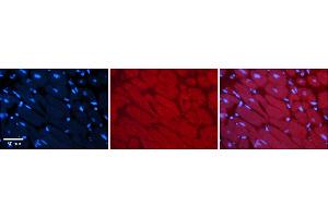 Rabbit Anti-MLXIP Antibody    Formalin Fixed Paraffin Embedded Tissue: Human Adult heart  Observed Staining: Cytoplasmic Primary Antibody Concentration: 1:100 Secondary Antibody: Donkey anti-Rabbit-Cy2/3 Secondary Antibody Concentration: 1:200 Magnification: 20X Exposure Time: 0.