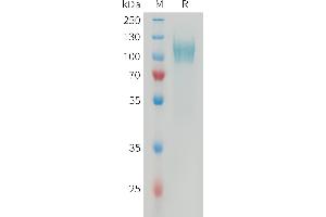 Human PDGFRA Protein, His Tag on SDS-PAGE under reducing condition.
