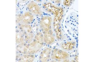 Immunohistochemistry of paraffin-embedded rat kidney using RPS2 antibody.