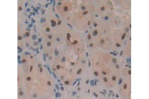 IHC-P analysis of Human Tissue, with DAB staining. (PLAGL1 anticorps  (AA 226-362))