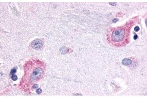 Anti-OPN3 / Encephalopsin antibody  ABIN1049166 IHC staining of human brain, neurons and glia. (OPN3 anticorps  (C-Term))