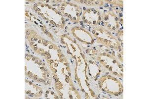 Immunohistochemistry of paraffin-embedded human kidney using PDGFRB antibody at dilution of 1:200 (x400 lens) (PDGFRB anticorps  (AA 887-1106))