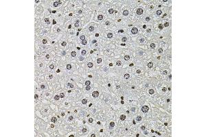 Immunohistochemistry of paraffin-embedded mouse liver using H2AFZ antibody (ABIN5973977) at dilution of 1/100 (40x lens). (H2AFZ anticorps)