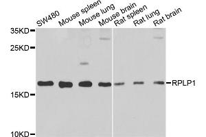 Western blot analysis of extracts of various cell lines, using RPLP1 antibody (ABIN5974064) at 1/1000 dilution. (RPLP1 anticorps)