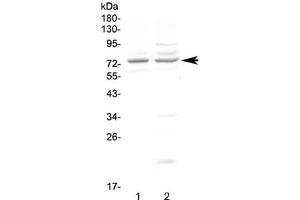 Western blot testing of human 1) COLO320 and 2) U-87 MG cell lysate with CHM antibody at 0. (CHM anticorps)