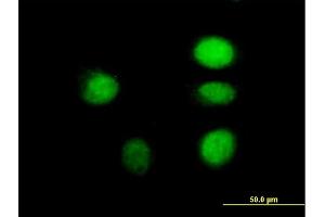 Immunofluorescence of purified MaxPab antibody to ARNT on HeLa cell.