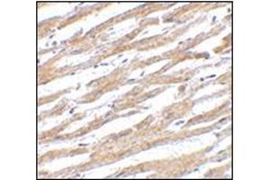 Immunohistochemistry of PDL-1 in human heart tissue with this product at 2. (PD-L1 anticorps  (Center))
