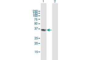 Western Blot analysis of GIPC2 expression in transfected 293T cell line by GIPC2 MaxPab polyclonal antibody. (GIPC2 anticorps  (AA 1-315))