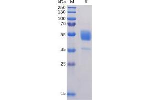 Human CD37 Protein, hFc Tag on SDS-PAGE under reducing condition. (CD37 Protein (Fc Tag))
