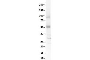lane 1:  Human Testis   primary antibody: SOX4 antibody - N-terminal region    primary antibody dilution:  1:1000   secondary antibody:  goat anti-rabbit-HRP   secondary antibody dilution:  1:10,000   blocking buffer:  3% milk in TBST   Actual Primary Conc (mg/mL):  0.