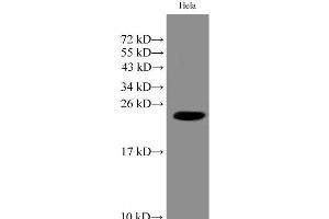 Western Blot analysis of Hela cell using IMP3 Polyclonal Antibody at dilution of 1:1000 (IMP3 anticorps)