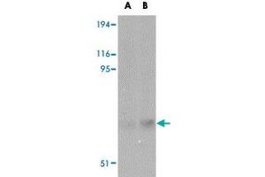 Western blot analysis of MATN2 in human liver tissue lysate with MATN2 polyclonal antibody  at (A) 1 and (B) 2 ug/mL .