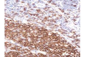 ABIN570905 (2µg/ml) staining of paraffin embedded Human Tonsil.