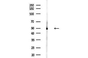 Western blot analysis of lysates from PC12 cells(heat-shock,45 min treatment), using Cytochrome P450 21 Antibody at 1/1000 dilution.