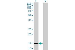 Western Blot analysis of ZNF593 expression in transfected 293T cell line by ZNF593 MaxPab polyclonal antibody. (ZNF593 anticorps  (AA 1-116))