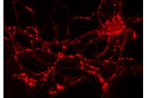 Immunolabeling of cultured hippocampus neurons (dilution 1 : 2000).