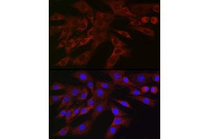 Immunofluorescence analysis of NIH/3T3 cells using PLK2 Rabbit pAb (ABIN6132905, ABIN6145776, ABIN6145778 and ABIN6222860) at dilution of 1:150 (40x lens).
