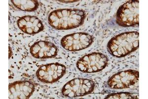 Image no. 4 for anti-Heat Shock 70kDa Protein 2 (HSPA2) (AA 1-640) antibody (ABIN598754) (HSPA2 anticorps  (AA 1-640))