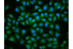 Immunofluorescence staining of Hela cells with ABIN7174438 at 1:100, counter-stained with DAPI. (UBE2D2 anticorps  (AA 1-147))