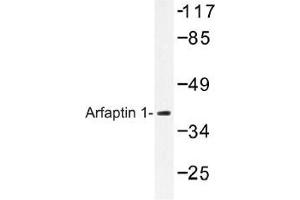 Image no. 1 for anti-ADP-Ribosylation Factor Interacting Protein 1 (ARFIP1) antibody (ABIN317818) (ARFIP1 anticorps)