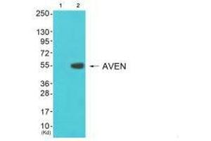 Western blot analysis of extracts from 3T3 cells (Lane 2), using COX17 antiobdy. (COX17 anticorps  (N-Term))