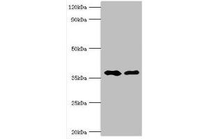 Western blot All lanes: Methylglutaconyl-CoA hydratase, mitochondrial antibody at 6 μg/mL Lane 1: Rat brain tissue Lane 2: Rat kidney tissue Secondary Goat polyclonal to rabbit IgG at 1/10000 dilution Predicted band size: 36, 33 kDa Observed band size: 36 kDa (AUH anticorps  (AA 68-339))