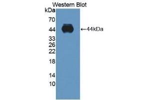 Detection of recombinant ADAMTS10 using Polyclonal Antibody to A Disintegrin And Metalloproteinase With Thrombospondin 10 (ADAMTS10) (ADAMTS10 anticorps  (AA 239-602))