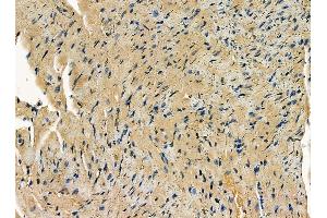 ABIN7095318 and ABIN7099375 at 1/100 staining mouse heart tissue by IHC-P.