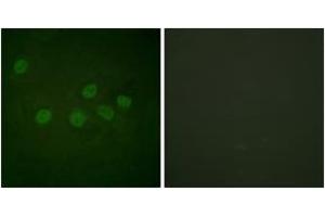 Immunofluorescence analysis of HeLa cells, using CBP (Ab-1535) Antibody. (CBP anticorps  (AA 1501-1550))