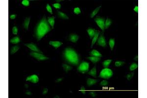Immunofluorescence of monoclonal antibody to GNB3 on HepG2 cell.