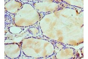Immunohistochemistry of paraffin-embedded human thyroid tissue using ABIN7175761 at dilution of 1:100 (WDR5 anticorps  (AA 1-334))